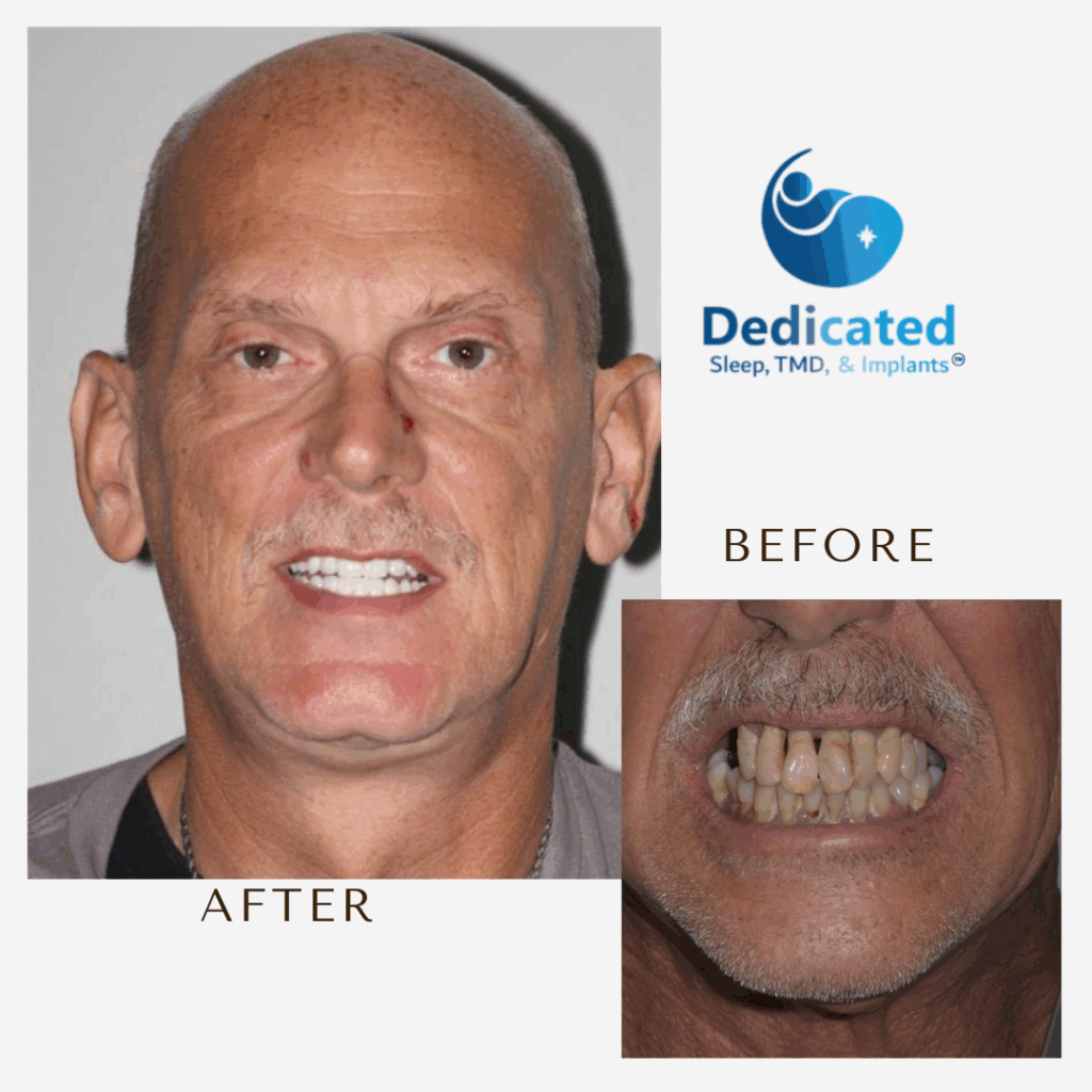 Black and White Minimalist Before After Beauty Instagram Post